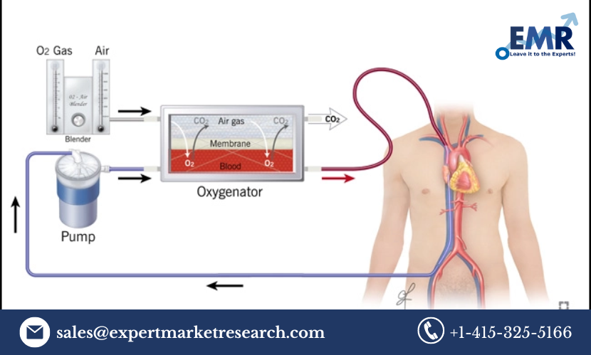 Extracorporeal Membrane Oxygenation Market Report Forecast