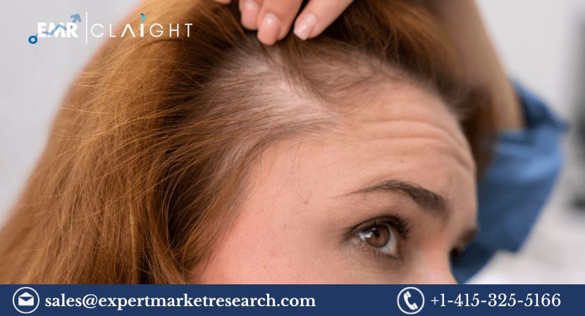 Read more about the article Alopecia Market to be Driven by the Rising Prevalence of Hair Loss in the Forecast Period of 2024-2032