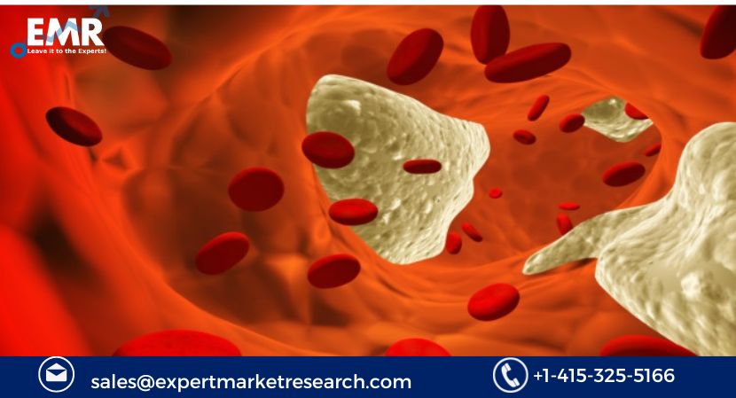 Read more about the article Global Antiplatelet Drugs Market to be Driven by Increasing Advancements in Pharmaceutical Industry and Increasing Heart Patients in the Forecast Period of 2024-2032