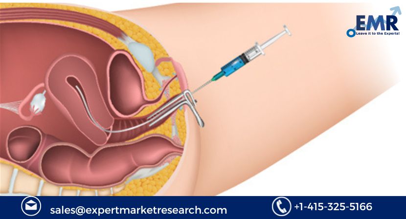 Read more about the article Global Artificial Insemination Market to be Driven due to the Increasing Number of Women being affected by Infertility in the Forecast Period of 2023-2031