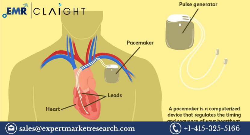 Global Cardiac Pacemaker Market To Be Driven By Increasing Growing Investments In The Healthcare