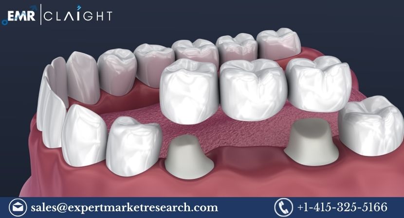 Read more about the article Global Dental Crowns and Bridges Market to be Driven by the Rapid Technological Advancements in the Forecast Period of 2024-2032