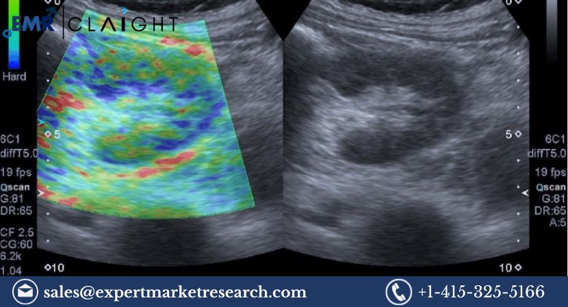 Read more about the article Global Elastography Imaging Market to be driven by the increased occurrences of chronic liver diseases and breast cancer in the Forecast Period of 2024-2032