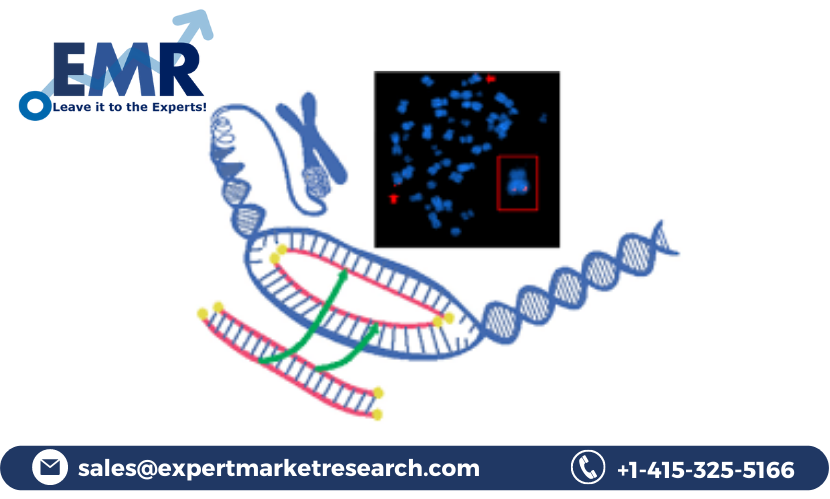 Read more about the article Global FISH Probe Market to be Driven by the Increasing Demand for the Diagnosis of Various Chronic Diseases in the Forecast Period of 2023-2028