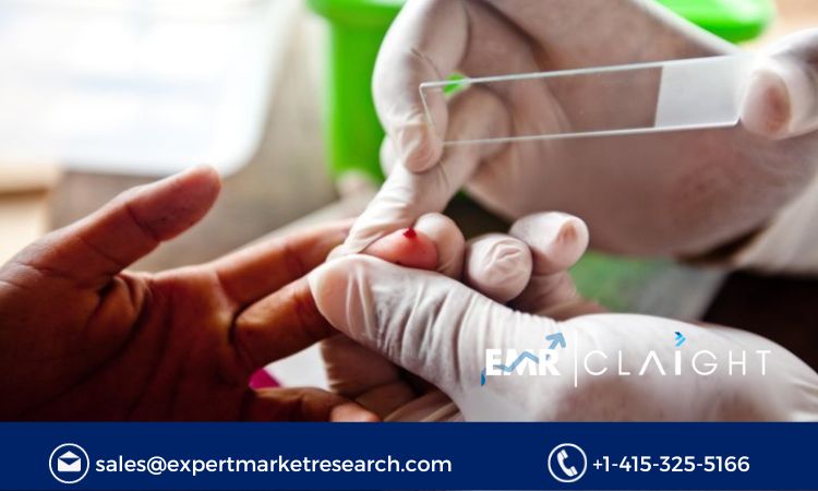 Read more about the article Malaria Diagnostics Market to be Driven by Rising Incidences of Malaria Among Children in the Forecast Period of 2024-2032