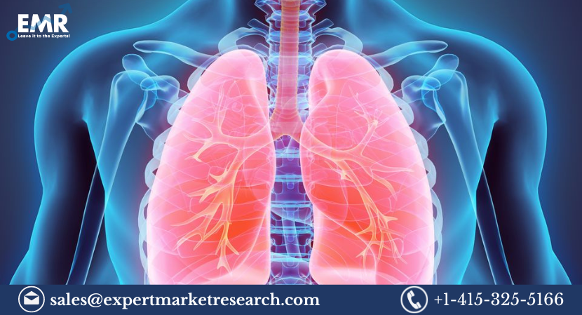 Read more about the article Global Malignant Mesothelioma Therapeutics Market to be Driven by at A CAGR of 7.4% in the Forecast Period of 2023-2028