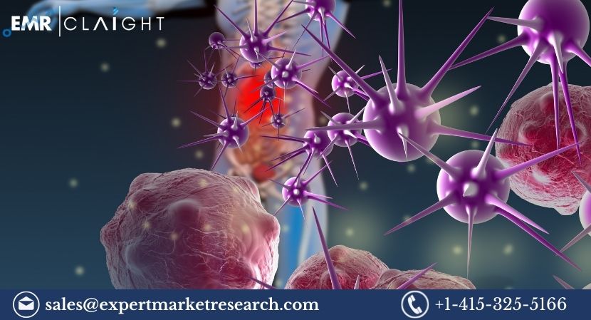 Read more about the article Global Parasitic Diseases Therapeutics Market to be driven by the Rising Initiatives and Programs to Eliminate Parasitic Diseases in the Forecast Period of 2024-2032