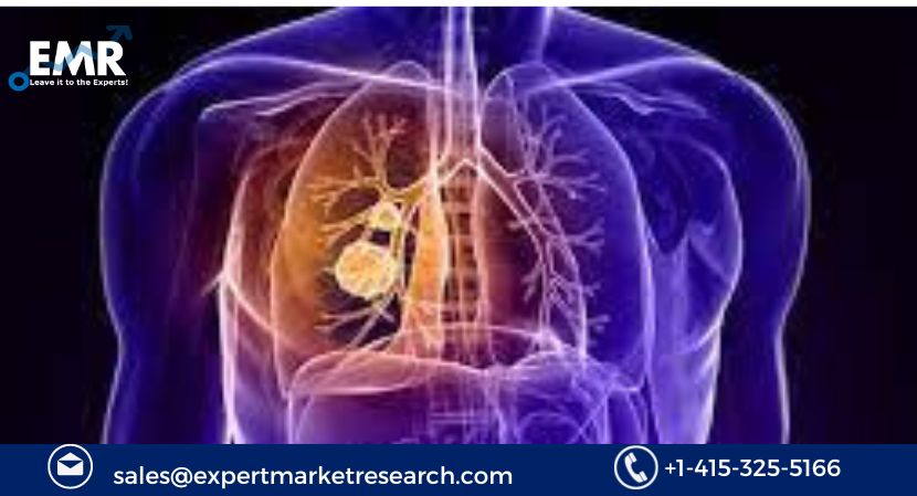 You are currently viewing Global Thoracic Surgery Market to be driven by increased demand and technological innovation in the Forecast Period of 2024-2032