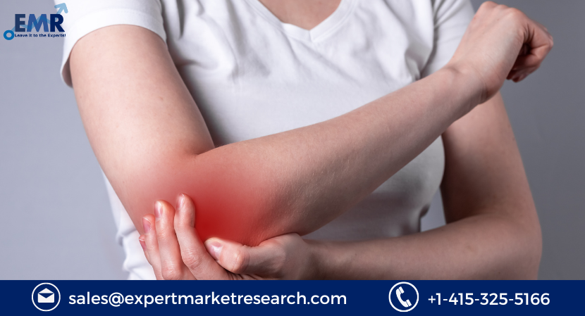 Read more about the article Topical Pain Relief Market to be Driven by the Increasing Prevalence of Arthritis and Other Bone-Related Diseases in the Forecast Period of 2023-2031