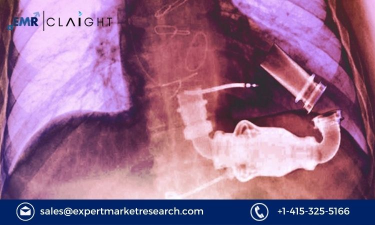 Read more about the article Global Ventricular Assist Device Market to be driven by increased demand for life saving devices in the Forecast Period of 2024-2032