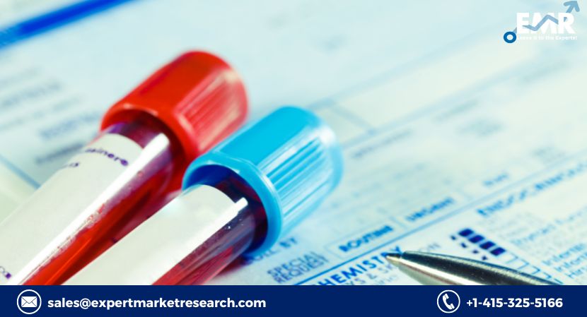 Read more about the article Global Haemato Oncology Testing Market to be Driven by Increasing Prevalence of Haematological Cancer in the Forecast Period of 2023-2028