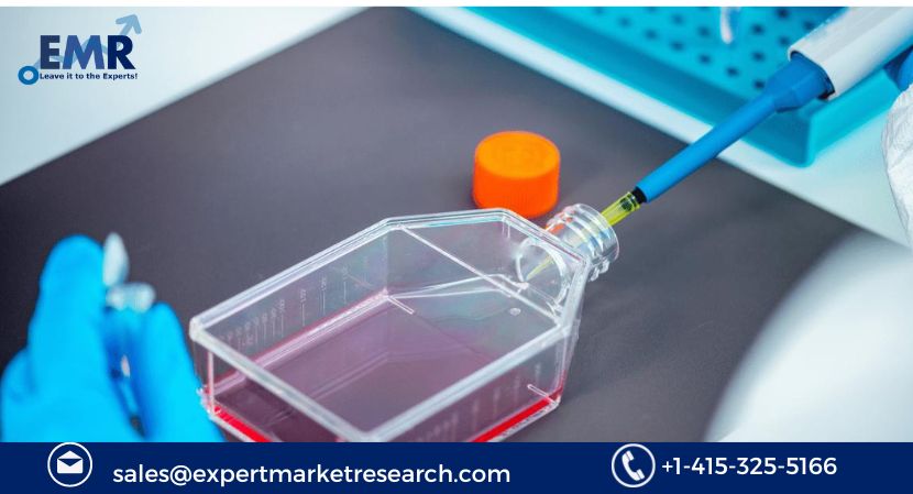 Read more about the article Global Serum Free Media Market Report to be driven by Rising Cases of Chronical Diseases in the forecast period of 2024-2032