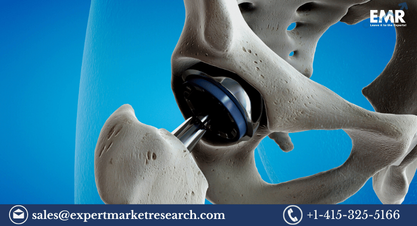 Read more about the article Global Orthopaedic Biomaterials Market to be Driven by the Increasing Geriatric Population in the Forecast Period of 2023-2028