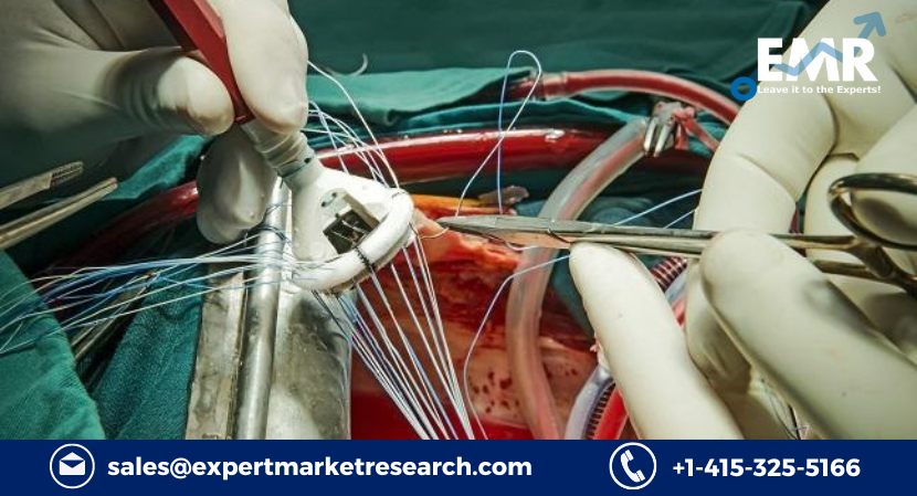 Read more about the article Global Aortic Valve Replacement Devices Market to be Driven by Expansion in Healthcare Infrastructure and Services in the Forecast Period of 2023-2028