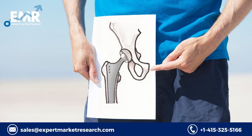 Read more about the article Global Hip Replacement Implants Market Likely to be Driven by Increased Need for Hip Replacement Procedures in the Forecast Period of 2024-2032