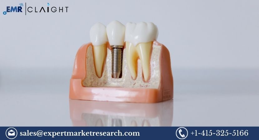 Read more about the article Global Aesthetic Implants Market to be Driven by Increasing Awareness towards Personal Care and Growing Disposable Income in the Forecast Period of 2024-2032