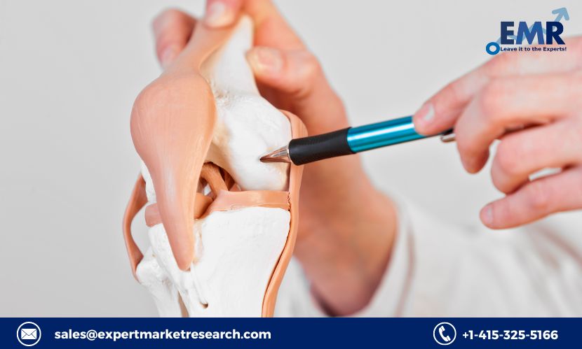 Read more about the article Global Knee Cartilage Repair Market to be Driven by Increasing Prevalence of Knee Injuries in the Forecast Period of 2024-2032