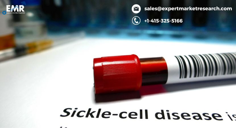 Read more about the article Global Sickle Cell Disease Treatment Market to be Driven by Rising Accessibility to Resources and Treatment Facilities in the Forecast Period of 2023-2031