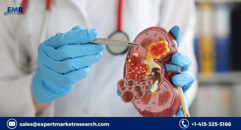 Read more about the article Global Urology Implants and Devices Market to be Driven by the Increased Demand for Effective Treatments for Urologic Conditions in the Forecast Period of 2023-2028