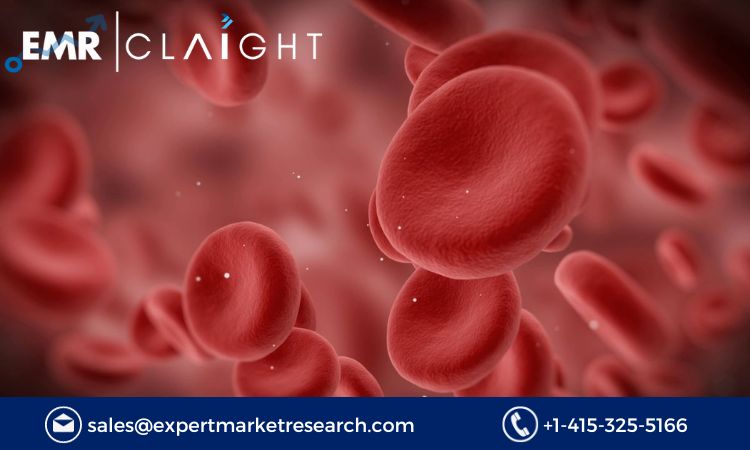 Read more about the article Global Anticoagulants Market to be Driven by Rising Lifestyle Risks Like Obesity and Diabetes in the Forecast Period of 2024-2032