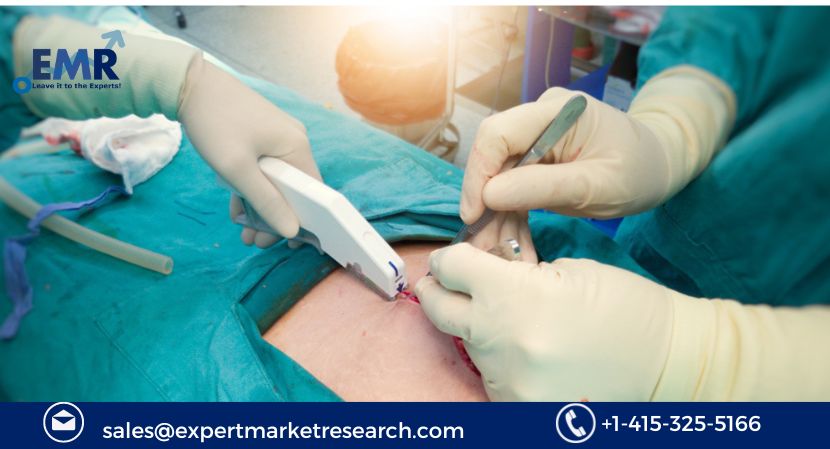 Read more about the article Global Surgical Staplers Market Outlook to be Driven by Rising Application of Surgical Staplers in the Medical Sector in the Forecast Period of 2024-2032