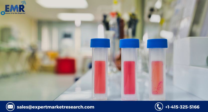 Read more about the article Global Agricultural Microbials Market to be Driven by the Growing Demand for Microbial-Based Solutions in the Forecast Period of 2023-2028