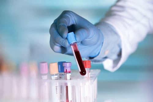 Read more about the article Global Bleeding Disorders Therapeutics Market to be Driven by the Growing Patient Population Base in the Forecast Period of 2022-2027 