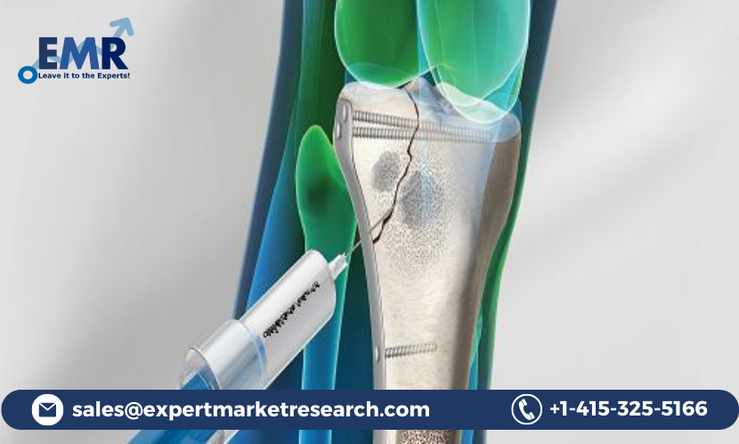 Read more about the article Global Bone Void Fillers Market to be Driven by the Rising Prevalence of Bone-Related Diseases in the Forecast Period of 2023-2028