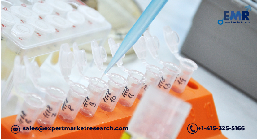 Read more about the article Latin America In-Vitro Diagnostics Market Growth to be Driven by the Demand for Quality Medical Care in the Forecast Period of 2024-2032 