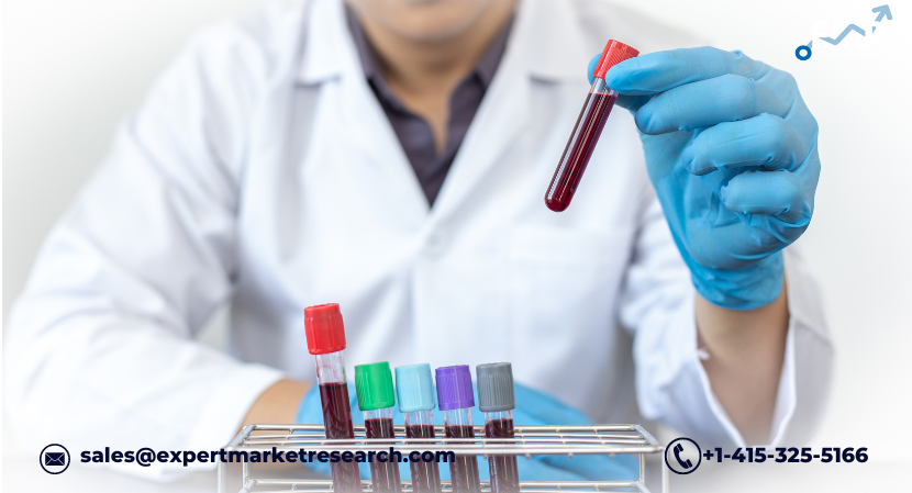 Read more about the article Mexico In-Vitro Diagnostics Market to be Driven by the Modernised Healthcare Facilities in the Forecast Period of 2024-2032 