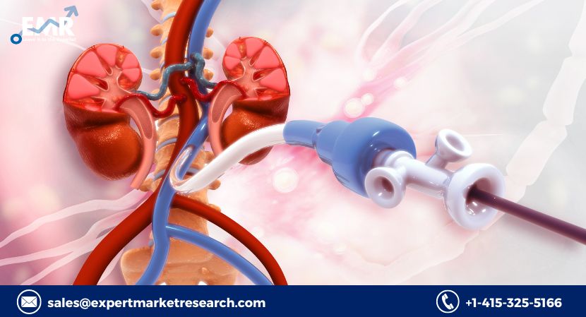 Read more about the article Global Cardiovascular Stents Market to be Driven by Rising Prevalence of Cardiovascular Diseases during the Forecast Period of 2023-2028