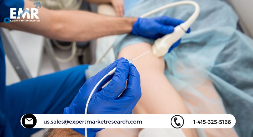 Read more about the article Global Catheter Stabilization Device/Catheter Securement Device Market Size to Grow at a CAGR of 7% Until 2027