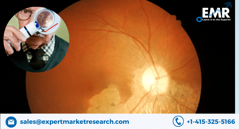 Read more about the article Global Age-Related Macular Degeneration (AMD) Market Size to Grow at a CAGR of 8.93% in the Forecast Period of 2023-2028