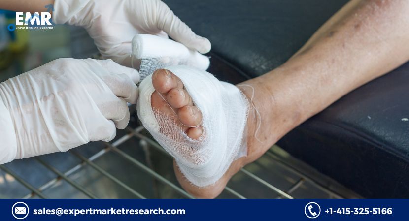 Read more about the article Global Diabetic Ulcer Treatment Market to be Driven by the Increasing Prevalence of Diabetes in the Forecast Period of 2024-2032