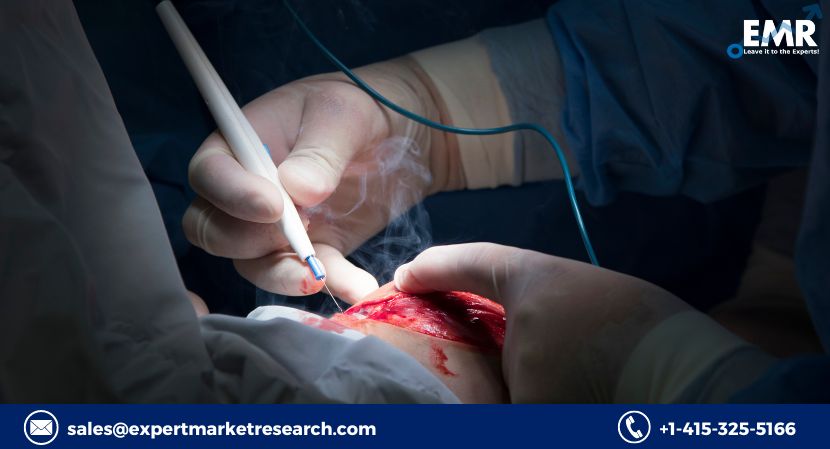 Read more about the article Global Electrosurgery Market to be Driven by the Increasing Prevalence of Connective Tissue Diseases in the Forecast Period of 2024-2032