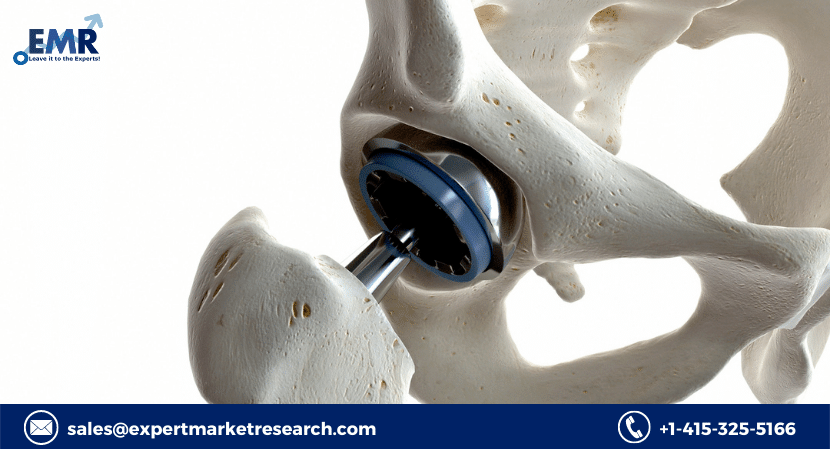 Read more about the article Global Orthopaedic Implants Market Size to Grow at a CAGR of 5% in the Forecast Period of 2022-2027