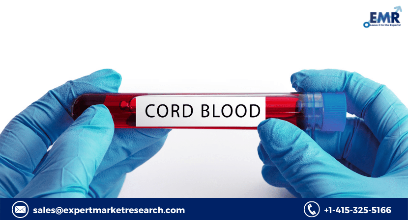 Read more about the article Global Umbilical Cord Blood Banking Market Size to Grow at a CAGR of 5.8% in the Forecast Period of 2024-2032