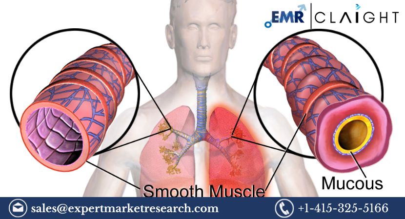 Read more about the article Global Bronchial Spasms Treatment Market Size to Grow at a CAGR of 4% in the Forecast Period of 2024-2032