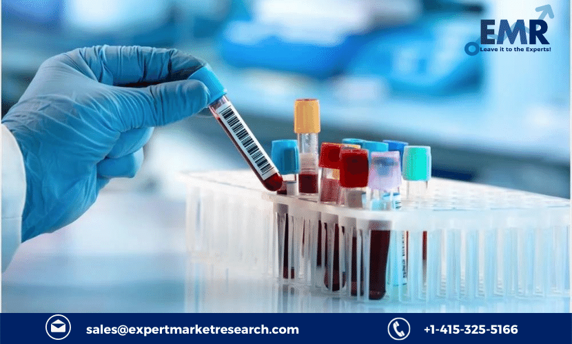 Read more about the article Global In-Vitro Diagnostics Market Size to Grow at a CAGR of 4.5% in the Forecast Period of 2023-2028