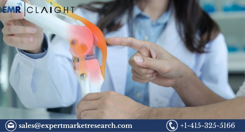 Read more about the article Global Knee Replacement Market Size to Grow at a CAGR of 4.89% in the Forecast Period of 2024-2032