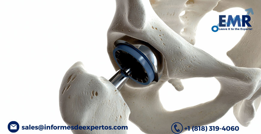 Read more about the article High Growth Estimations for Latin America Orthopaedic Implants Market During 2023-2028 due to Rising Geriatric Population and Demand for Reconstructive Joint Replacements