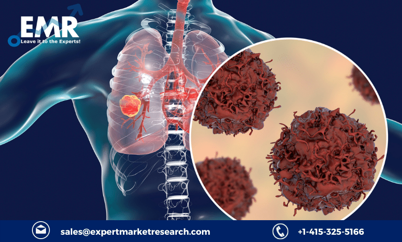 Read more about the article Global Lung Cancer Therapeutics Market Size to Grow at a CAGR of 11.60% in the Forecast Period of 2023-2031