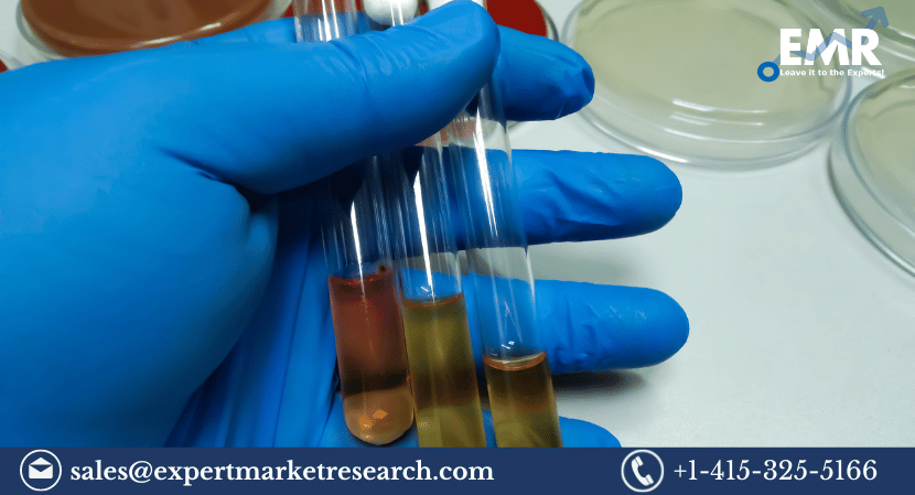 Read more about the article Global Urease Market to be Driven by the Increasing Demand for Biosensors in the Forecast Period of 2023-2028