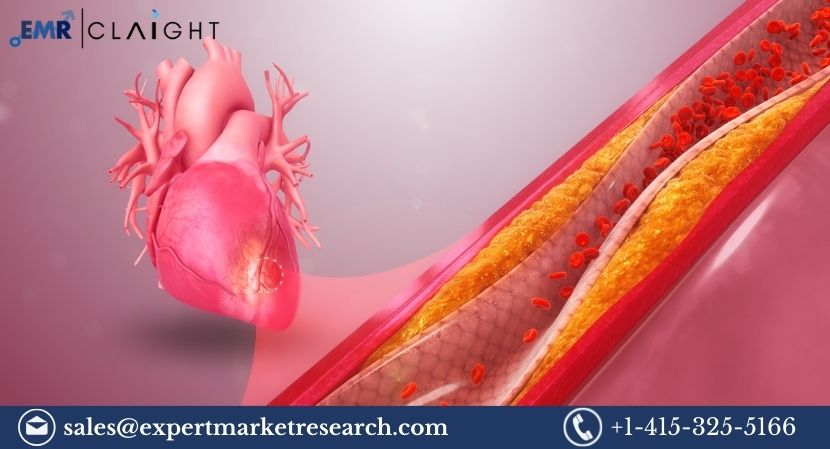 Read more about the article Global Acute Coronary Syndrome Treatment Market Size to Be Aided by the Rising Prevalence of Cardiovascular Diseases Report 2024-2032