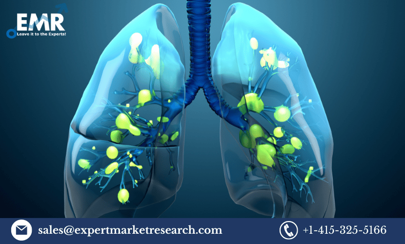 Read more about the article Global Acute Respiratory Syndrome Treatment Market Size to Attain a Value of USD 2045 Million by 2031