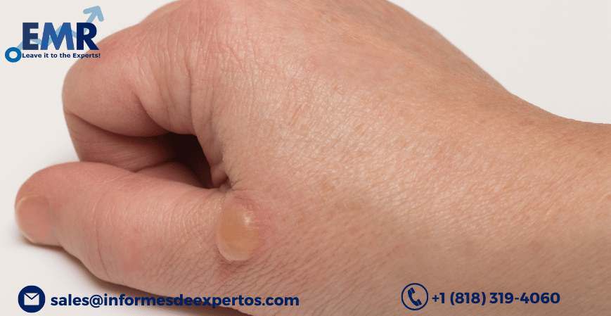 Read more about the article Latin America Bullous Pemphigoid Treatment Market Size to Expand with Lofty Government Investments in Medical Sector During 2023-2028