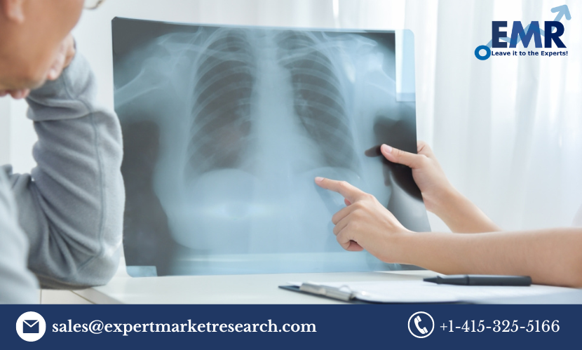 Read more about the article Global Pleural Effusion Treatment Market Size to Grow at a CAGR of 4.90% in the Forecast Period of 2023-2028