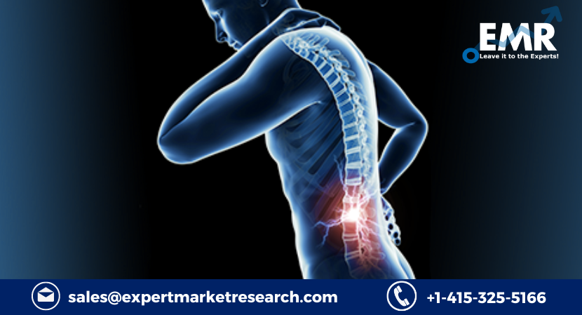 Read more about the article Global Spinal Cord Stimulation Market Size to Grow at a CAGR of 8.10% in the Forecast Period of 2023-2028