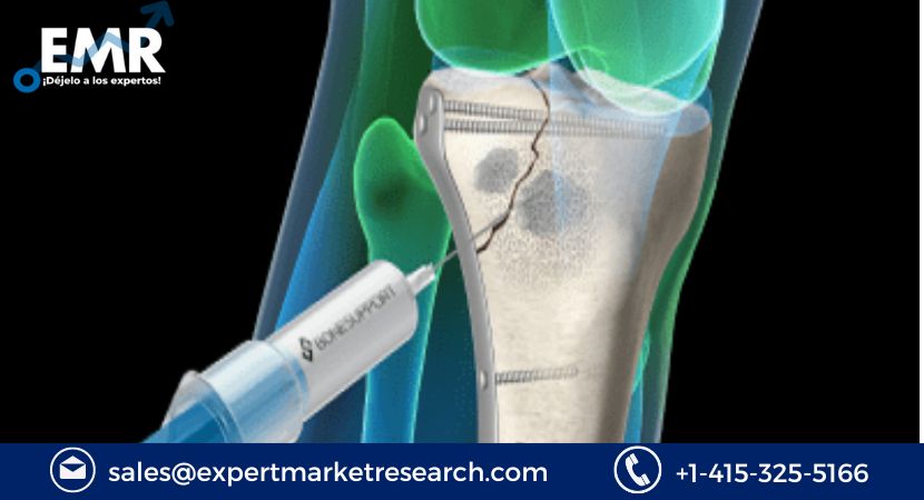 Read more about the article Global Bone Void Fillers Market Size to Grow at a CAGR of 6.8% in the Forecast Period of 2024-2032