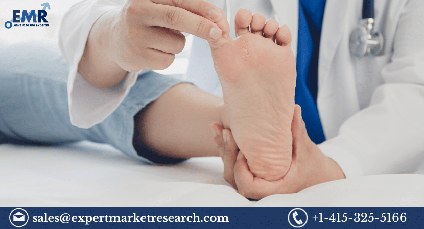 Read more about the article Global Athlete’s Foot Treatment Market Size to Grow at a Healthy Rate in the Forecast Period of 2023-2031